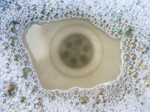 Clogged kitchen sink